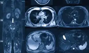 Что Такое Кт Всего Организма и Его Применение