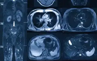 Что Такое Кт Всего Организма и Его Применение