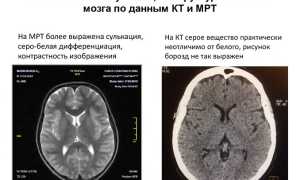 Что Лучше Кт Или Мрт Всего Организма Для Диагностики?
