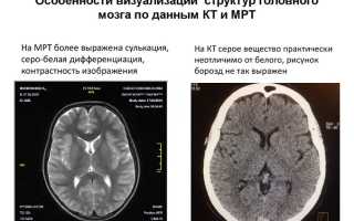 Что Лучше Кт Или Мрт Всего Организма Для Диагностики?