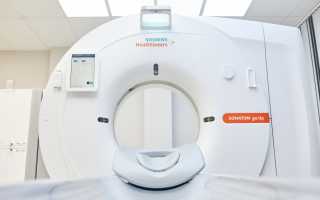 Как Проходит Кт Легких Без Контраста и Что Нужно Знать