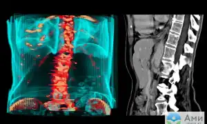 Контрастирование При Кт Что Это и Как Используется