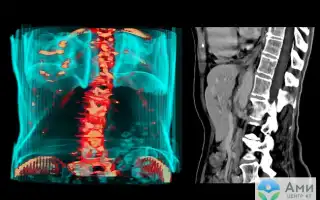 Контрастирование При Кт Что Это и Как Используется
